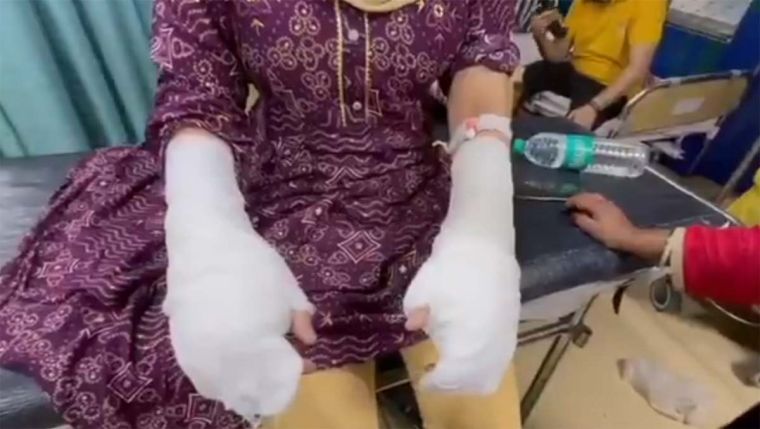 Acid attack allegation devolves into fabrication plot, father of alleged victim arrested