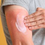 Beat the Heat: How to Keep Your Skin Hydrated and Sunburn-Free This Summer