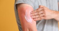 Beat the Heat: How to Keep Your Skin Hydrated and Sunburn-Free This Summer