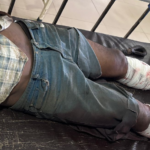 Nagaon Dacoity-Murder Prime accused Critically Injured in Late-Night Police Vehicle Crash