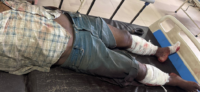 Nagaon Dacoity-Murder Prime accused Critically Injured in Late-Night Police Vehicle Crash